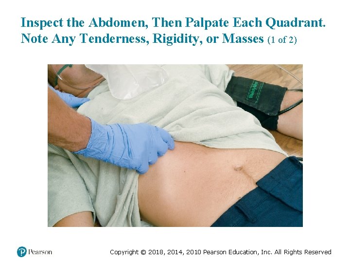 Inspect the Abdomen, Then Palpate Each Quadrant. Note Any Tenderness, Rigidity, or Masses (1