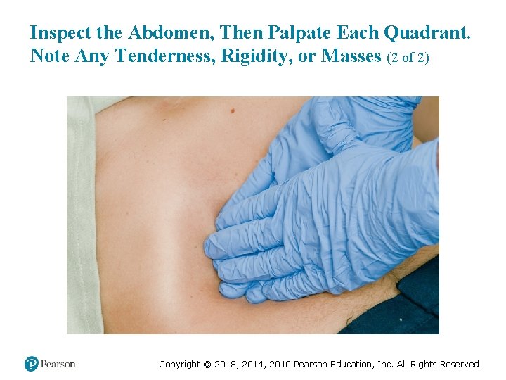 Inspect the Abdomen, Then Palpate Each Quadrant. Note Any Tenderness, Rigidity, or Masses (2