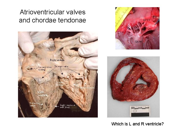 Atrioventricular valves and chordae tendonae Which is L and R ventricle? 