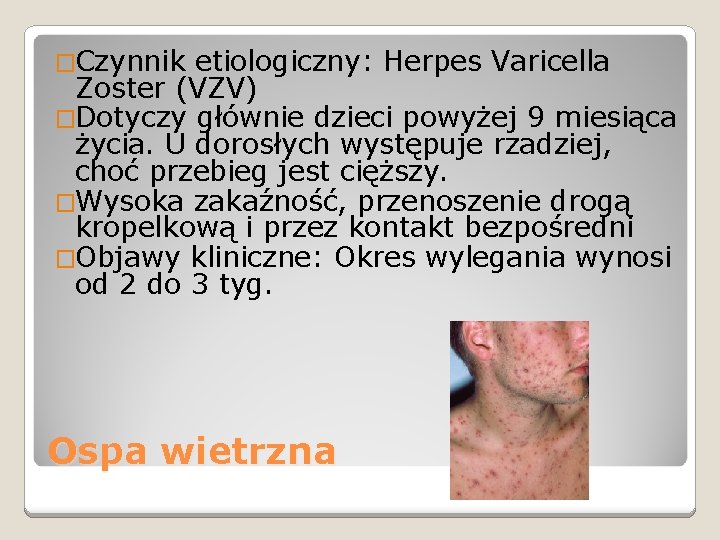 �Czynnik etiologiczny: Herpes Varicella Zoster (VZV) �Dotyczy głównie dzieci powyżej 9 miesiąca życia. U