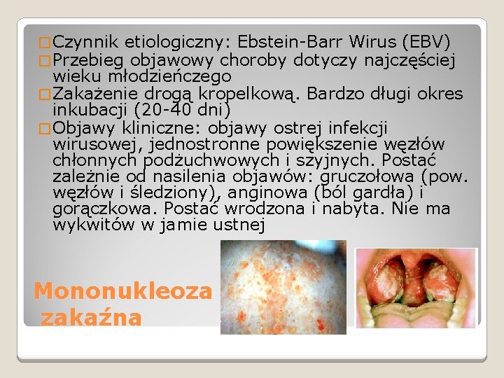 � Czynnik etiologiczny: Ebstein-Barr Wirus (EBV) � Przebieg objawowy choroby dotyczy najczęściej wieku młodzieńczego