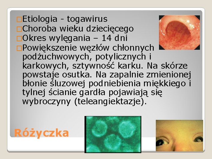 �Etiologia - togawirus �Choroba wieku dziecięcego �Okres wylęgania – 14 dni �Powiększenie węzłów chłonnych
