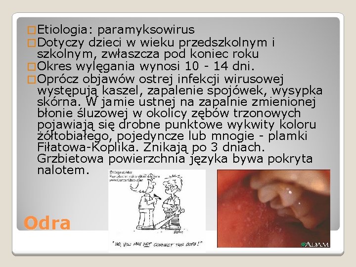 � Etiologia: paramyksowirus � Dotyczy dzieci w wieku przedszkolnym i szkolnym, zwłaszcza pod koniec