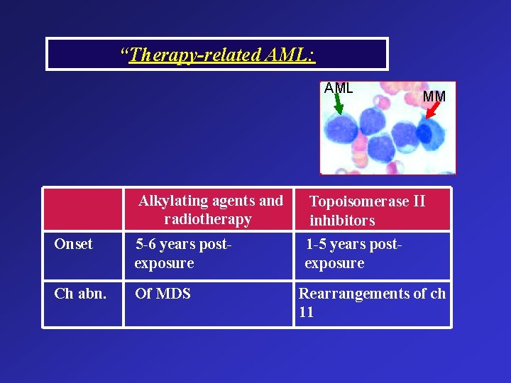“Therapy-related AML: AML MM Alkylating agents and radiotherapy Topoisomerase II inhibitors Onset 5 -6