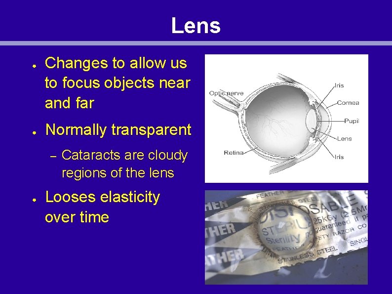 Lens ● ● Changes to allow us to focus objects near and far Normally