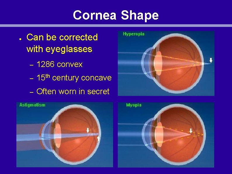 Cornea Shape ● Can be corrected with eyeglasses – 1286 convex – 15 th