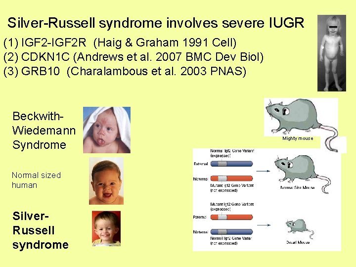 Silver-Russell syndrome involves severe IUGR (1) IGF 2 -IGF 2 R (Haig & Graham