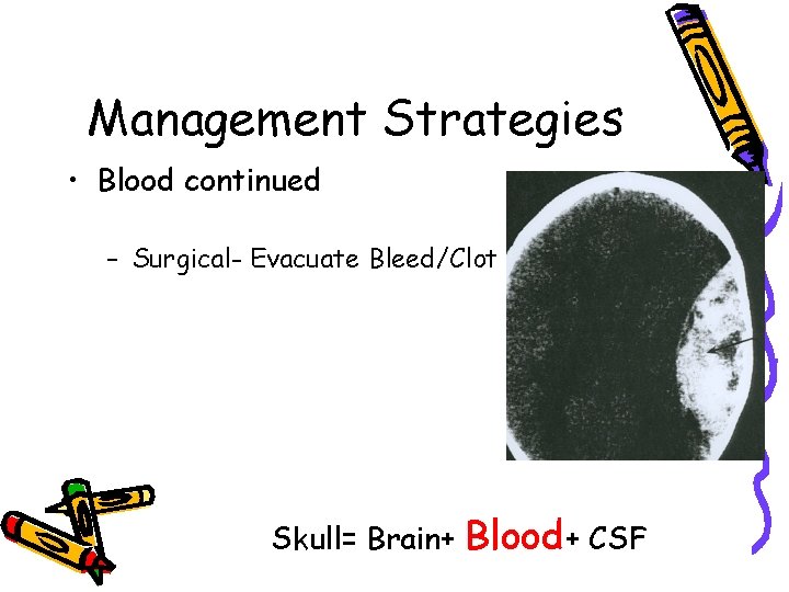 Management Strategies • Blood continued – Surgical- Evacuate Bleed/Clot Skull= Brain+ Blood+ CSF 