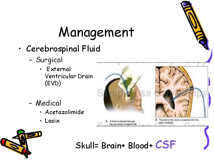 Management • Cerebrospinal Fluid – Surgical • External Ventricular Drain (EVD) – Medical •