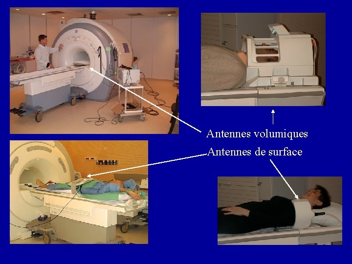 Antennes volumiques Antennes de surface 