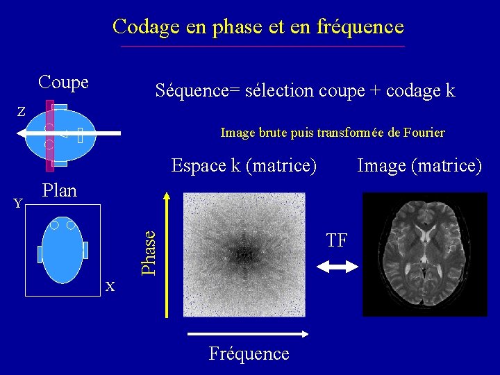 Codage en phase et en fréquence Coupe Séquence= sélection coupe + codage k Z