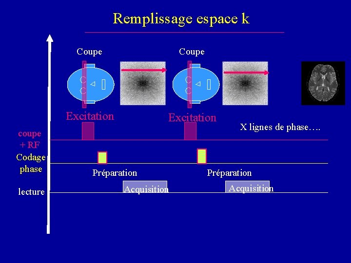 Remplissage espace k coupe + RF Codage phase lecture Coupe Excitation Préparation Acquisition X