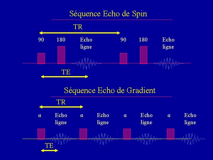 Séquence Echo de Spin TR 90 180 Echo ligne TE Séquence Echo de Gradient