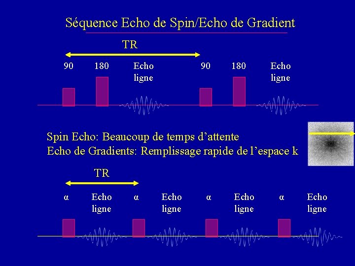 Séquence Echo de Spin/Echo de Gradient TR 90 180 Echo ligne Spin Echo: Beaucoup