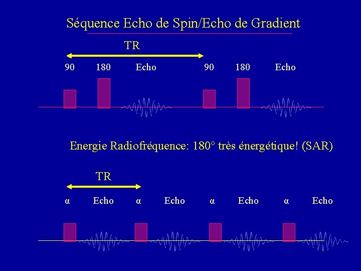 Séquence Echo de Spin/Echo de Gradient TR 90 180 Echo Energie Radiofréquence: 180° très
