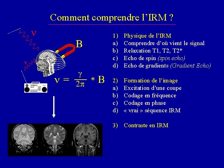 Comment comprendre l’IRM ? 1) a) b) c) d) Physique de l’IRM Comprendre d’où