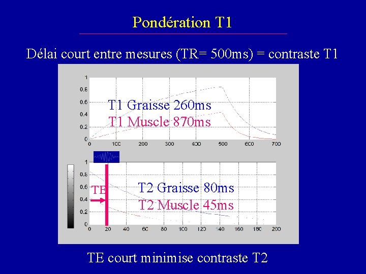 Pondération T 1 Délai court entre mesures (TR= 500 ms) = contraste T 1