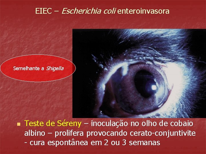 EIEC – Escherichia coli enteroinvasora Semelhante a Shigella n Teste de Séreny – inoculação