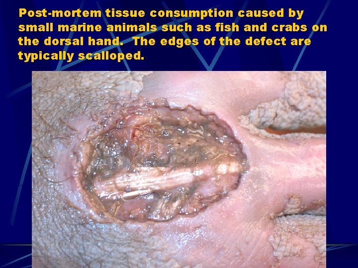 Post-mortem tissue consumption caused by small marine animals such as fish and crabs on