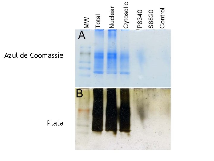 Azul de Coomassie Plata 