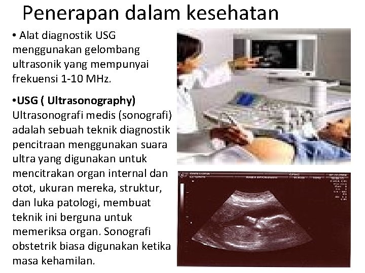 Penerapan dalam kesehatan • Alat diagnostik USG menggunakan gelombang ultrasonik yang mempunyai frekuensi 1