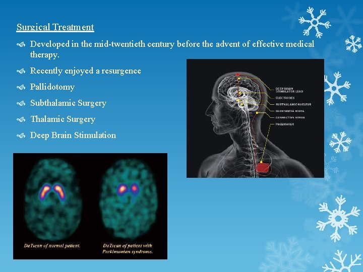 Surgical Treatment Developed in the mid-twentieth century before the advent of effective medical therapy. Surgical Treatment Developed in the mid-twentieth century before the advent of effective medical therapy.