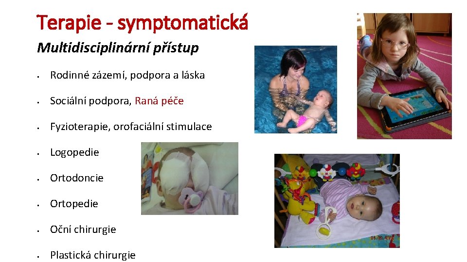 Terapie - symptomatická Multidisciplinární přístup § Rodinné zázemí, podpora a láska § Sociální podpora,