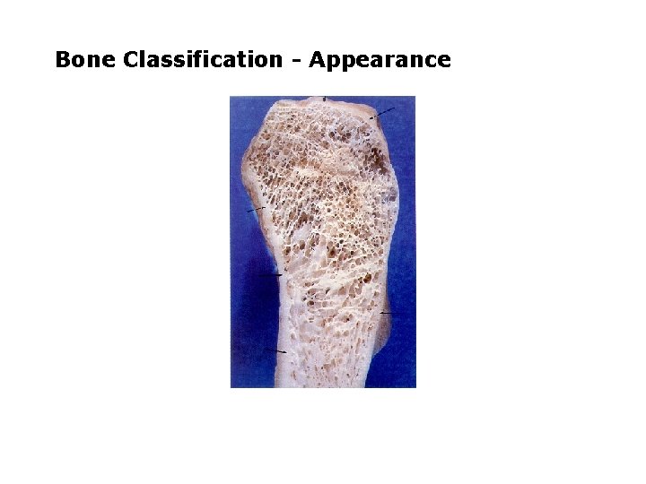 Bone Classification - Appearance 