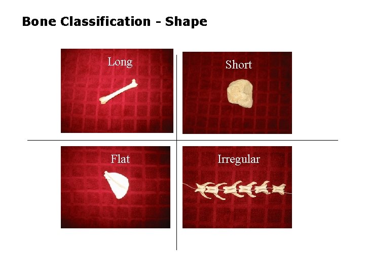 Bone Classification - Shape Long Short Flat Irregular 