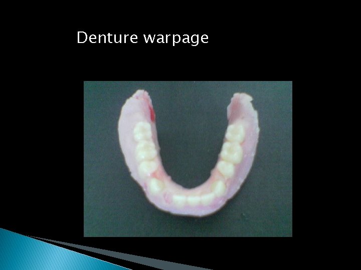 Denture warpage 