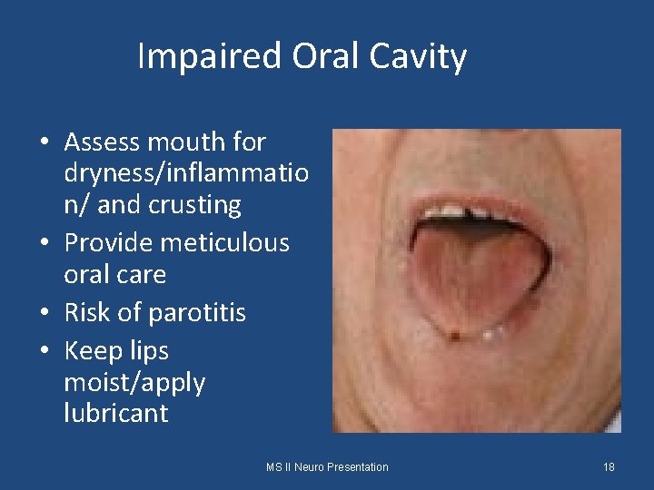 Impaired Oral Cavity • Assess mouth for dryness/inflammatio n/ and crusting • Provide meticulous