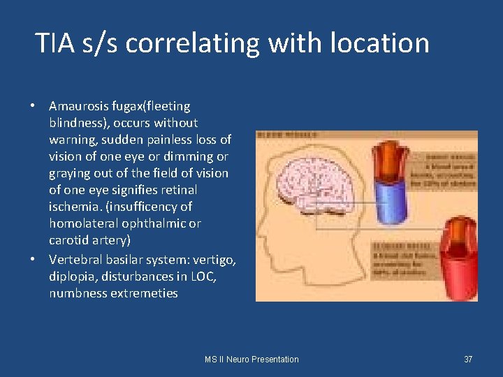 TIA s/s correlating with location • Amaurosis fugax(fleeting blindness), occurs without warning, sudden painless
