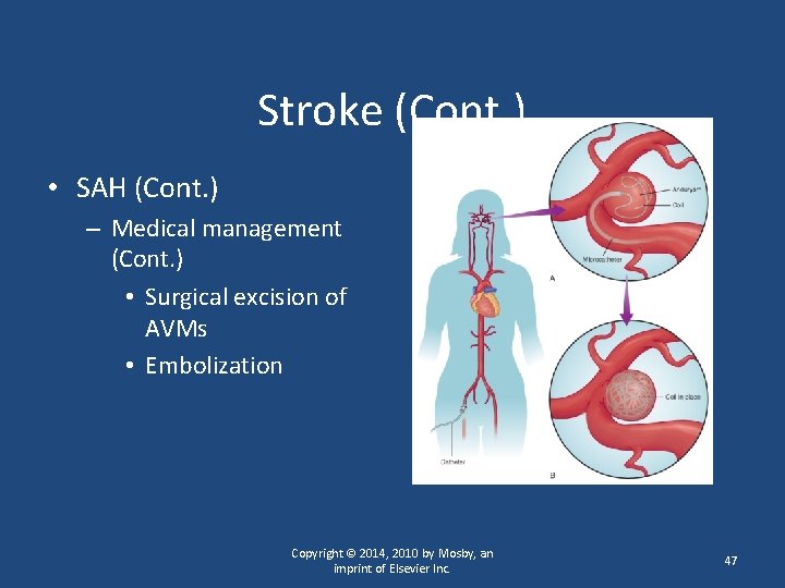 Stroke (Cont. ) • SAH (Cont. ) – Medical management (Cont. ) • Surgical