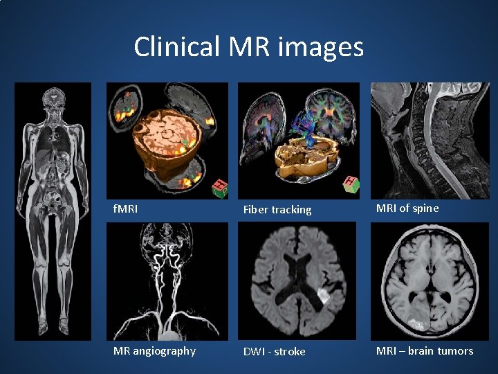 Clinical MR images f. MRI Fiber tracking MRI of spine MR angiography DWI -