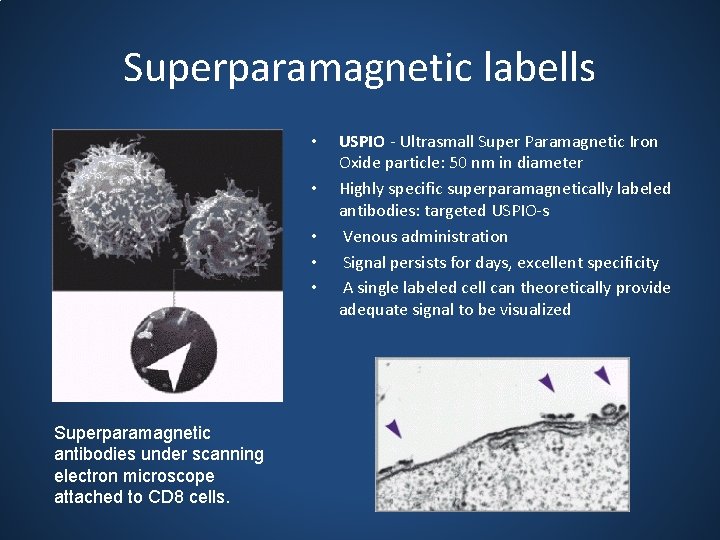 Superparamagnetic labells • • • Superparamagnetic antibodies under scanning electron microscope attached to CD