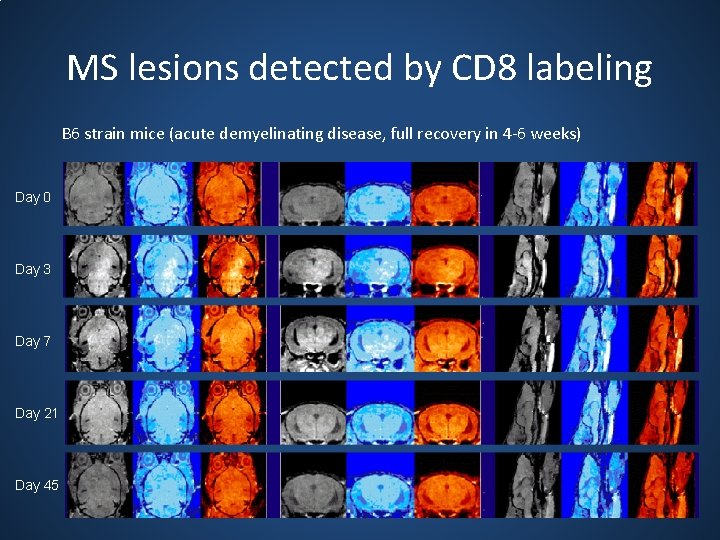 MS lesions detected by CD 8 labeling B 6 strain mice (acute demyelinating disease,