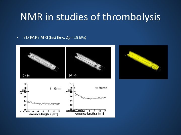NMR in studies of thrombolysis • 3 D RARE MRI (fast flow, ∆p =