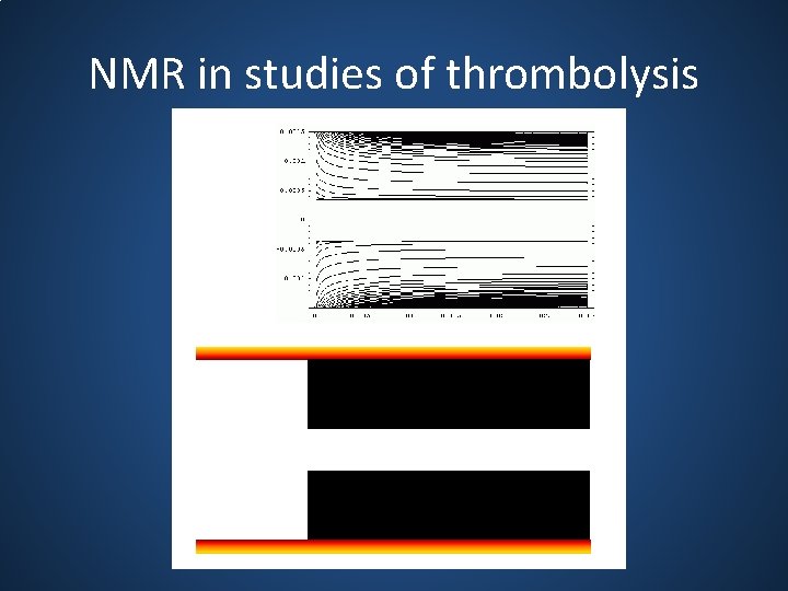 NMR in studies of thrombolysis 