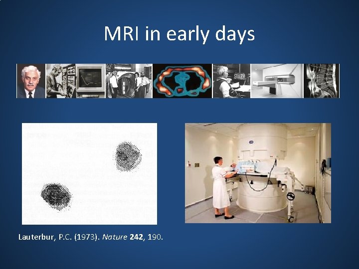 MRI in early days Lauterbur, P. C. (1973). Nature 242, 190. 