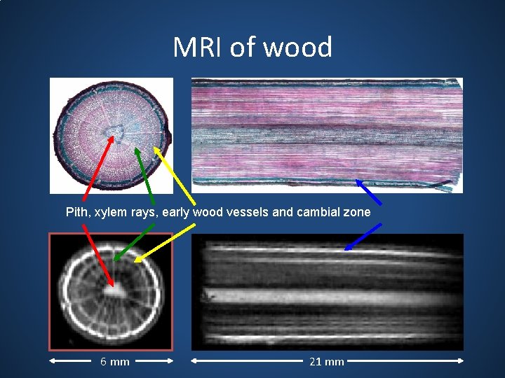 MRI of wood Pith, xylem rays, early wood vessels and cambial zone 6 mm