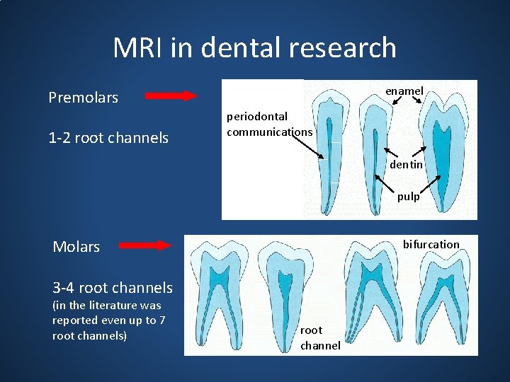 MRI in dental research enamel Premolars 1 -2 root channels periodontal communications dentin pulp