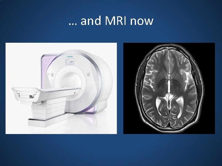 … and MRI now 