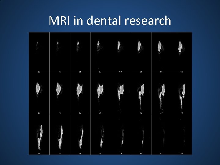 MRI in dental research 