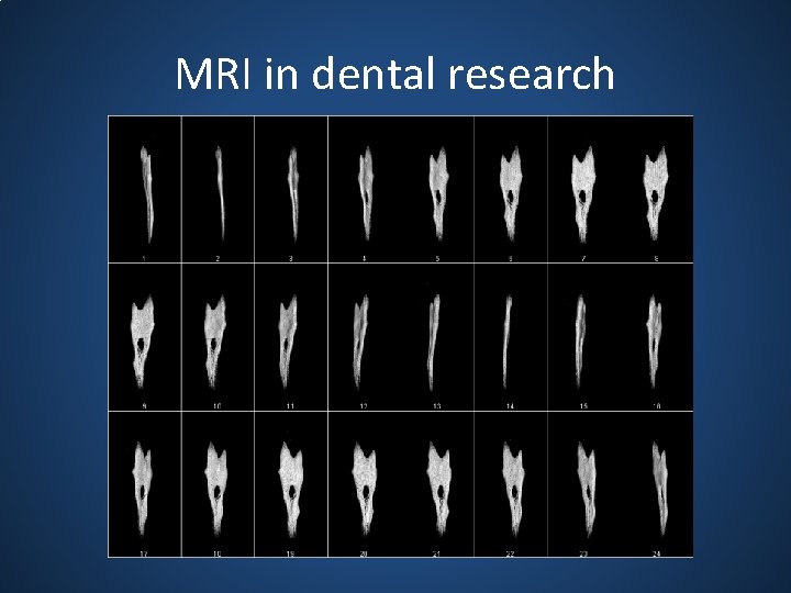 MRI in dental research 