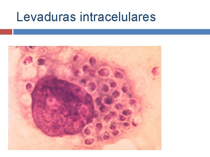 Levaduras intracelulares 
