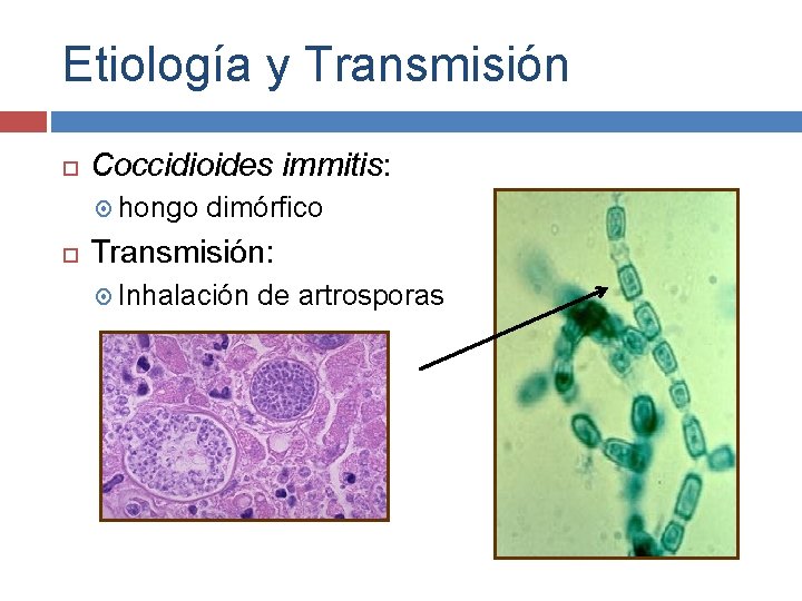 Etiología y Transmisión Coccidioides immitis: hongo dimórfico Transmisión: Inhalación de artrosporas 