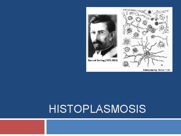 HISTOPLASMOSIS 