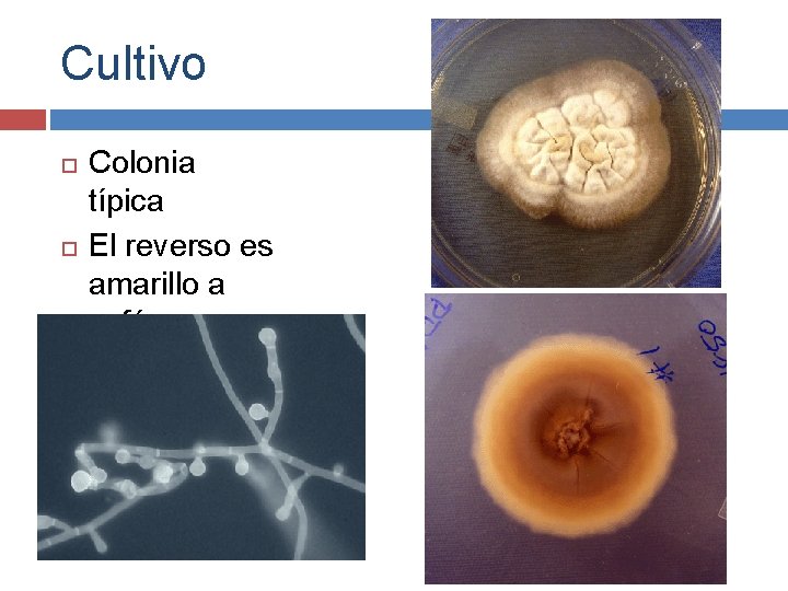 Cultivo Colonia típica El reverso es amarillo a café. 