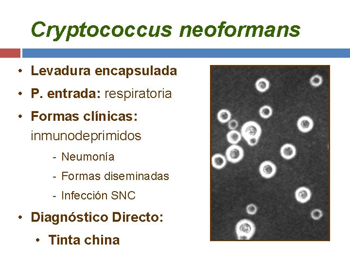 Cryptococcus neoformans • Levadura encapsulada • P. entrada: respiratoria • Formas clínicas: inmunodeprimidos -