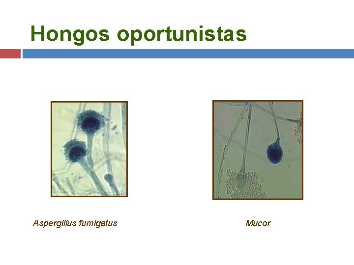 Hongos oportunistas Aspergillus fumigatus Mucor 